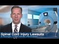 Spinal injuries after a car, truck or motorcycle accident are life-changing and extremely challenging for the victim and his or her family. In this video, attorney Charles Scholle shares the approach his firm takes in representing victims of spinal injury.