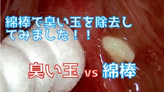 綿棒を使って臭い玉を除去してみました【綿棒vs臭い玉】