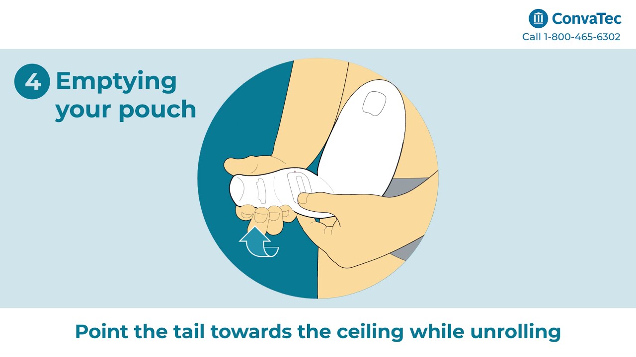 ESTEEM®+ with ConvaTec Moldable Technology™ - Designed for people living with an ostomy.