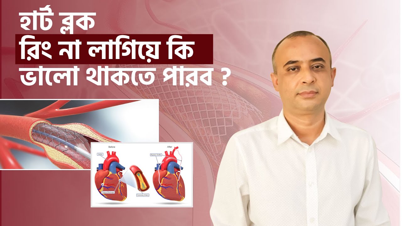 হার্ট ব্লক রিং না লাগিয়ে কি ভালো থাকা সম্ভব❓ | ডাঃ গোলাম মোর্শেদ