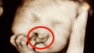 これはレストランにいた生まれつき障害のある赤ん坊に手渡されたメモ。母親は言葉を失った！