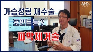 [엠디TV] 가슴성형 재수술  포인트는 피막제거술 (모양, 촉감, 크기 개선)