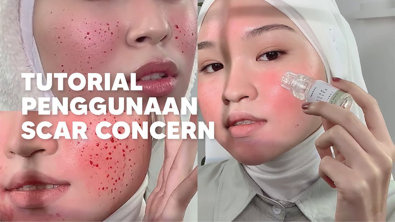 Scar Update Example Tutorial penggunaan Scar Concern - Update 2023 - YouTube