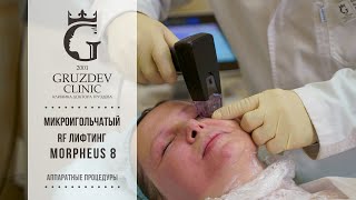 Микроигольчатый RF-лифтинг Morpeus 8