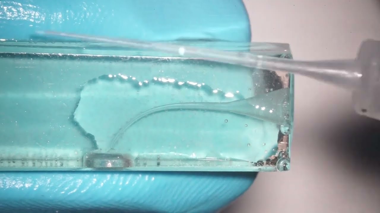 Irriflex vs standard endo irrigation tips