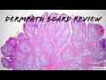 Dermatopathology Board Review For Dermatology Pathology Dermpath 19 Classic Cases