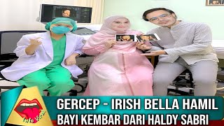 GERCEP - Irish Bella Pamer Hamil Bayi Kembar dari Haldy Sabri ?!
