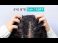 Home remedies to get rid of dandruff permanently 10 natural dandruff remedies that work