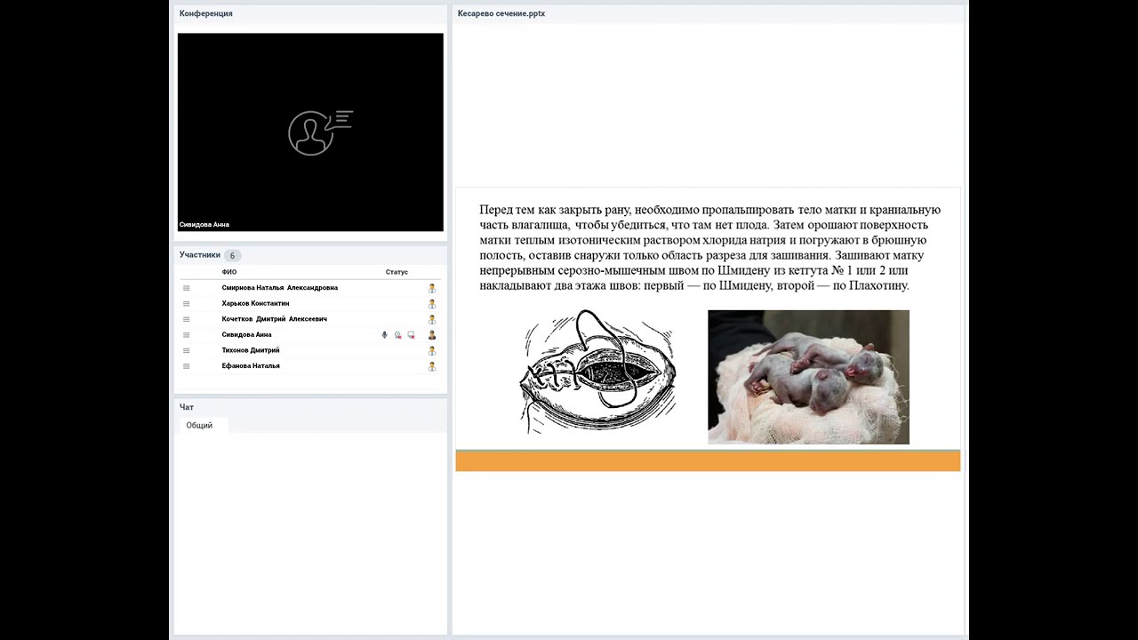 Кесарево сечение. Показания к операции. Протокол анестезии. - YouTube