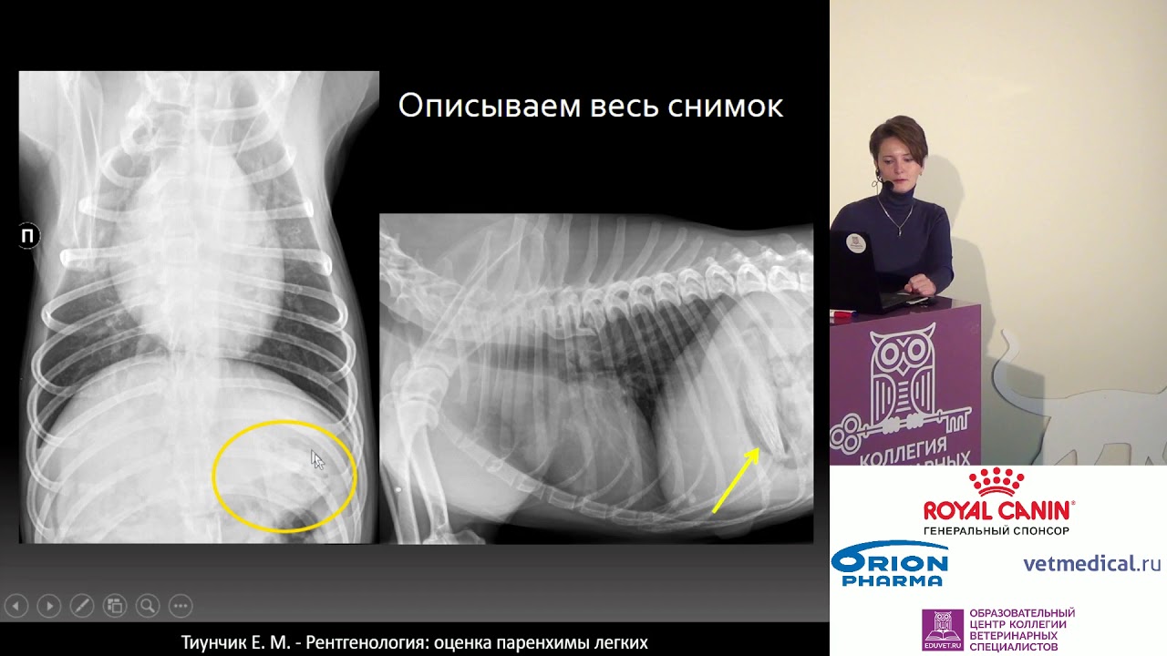 Тиунчик Е. М. - Рентгенология: оценка паренхимы легких