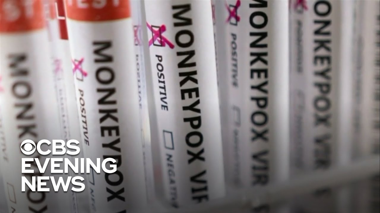 U.S. moves to stretch out monkeypox vaccine supply - YouTube