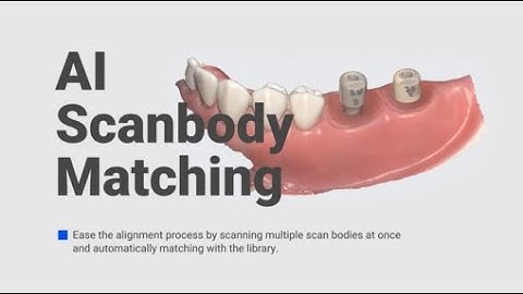 Medit i700 | Better for Patients, Easier for Dentists | Smart Software | AI Scanbody Matching