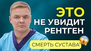 Асептический некроз или смерть сустава. Как заподозрить и не допустить? Можно ли вылечить?