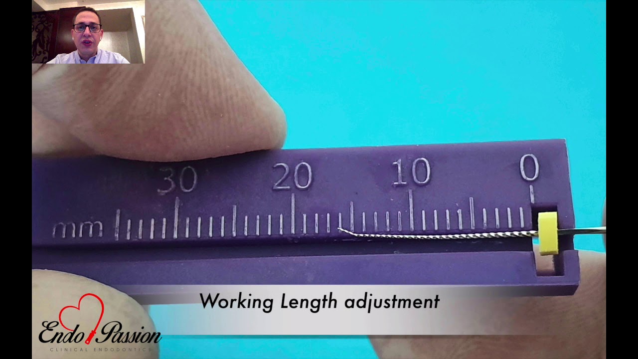 Ledge management and bypass