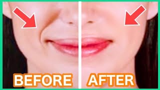 ⁣Get Rid Of Smile Lines with This Massage❤️! (Nasolabial Folds/ Laugh Lines)