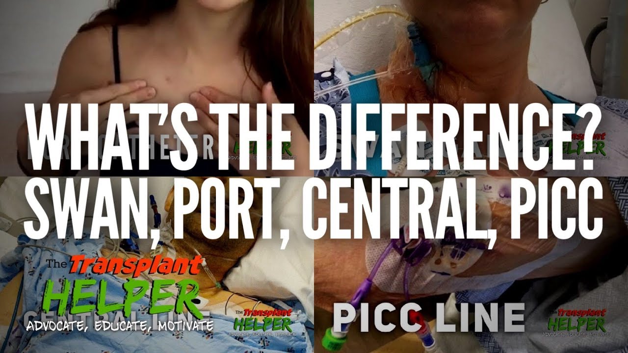 Swan Ganz, Port, Central, & PICC What's The Difference? YouTube