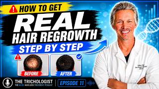 Stop Hair Loss & REGROW IT: The Ultimate Step-by-Step Guide