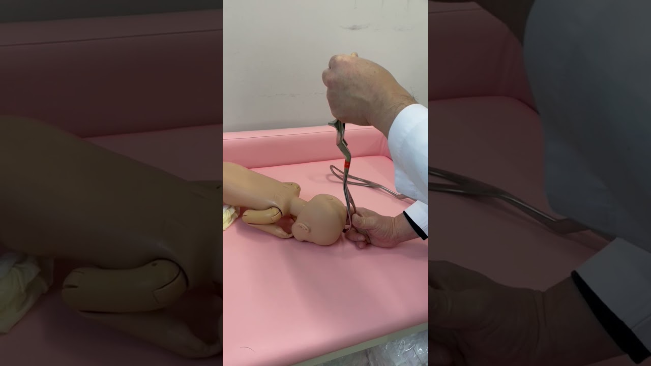 安全な鉗子の挿入と抜去