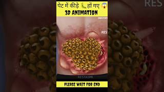 पेट में कीड़े ?हों गए ? | There are worms in the stomach | 3d animation| asmr youtube shorts