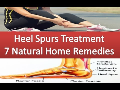 Heel Spurs Treatment With 7 Natural Home Remedies for Heel Spurs to Relieve the Pain