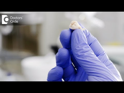 Video: Swelling After Removal Of A Wisdom Tooth: How Long Does It Last, How To Remove It