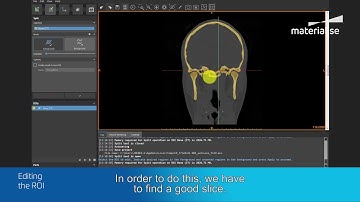 Hoe maak je een 3D-model van de schedel en de onderkaak | Materialise Mimics inPrint Tutorial