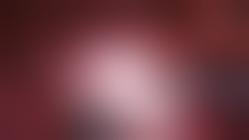 Robotic S9-S10 Segmentectomy Assisted by Multimodal Reconstruction Imaging System