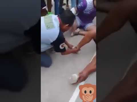 #EN VIDEO IMPRESIONANTE momento en que a un deportista se disloca el tobillo en pleno encuentro