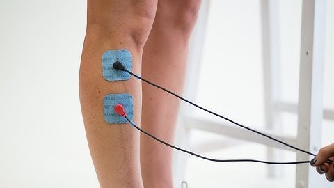 Compex Muscle Stim: Pad Placement for Shin Splints