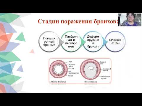 Бронхоэктатическая болезнь
