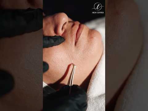 لاین جدید محصولات جوان سازی با نخ کلاژن فیشال پاکسازی پوست