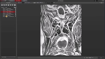 Leica LAS X Navigator: Z-stacks of varying sizes