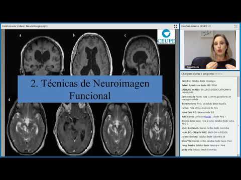 Vídeo: Características De Neuroimagen De La Expansión C9ORF72