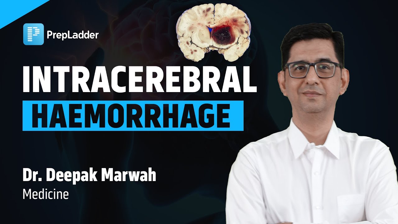 Intracerebral Hemorrhage - Hypertensive Intracerebral Hemorrhage