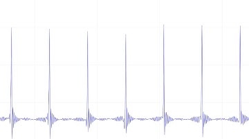 EEPROM Data Logging Project