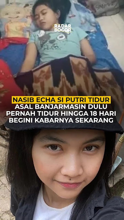 Download lagu Nasib Echa Si Putri Tidur Asal Banjarmasin Dulu Pernah Tidur Hingga 18 Hari Begini Kabarnya Sekarang