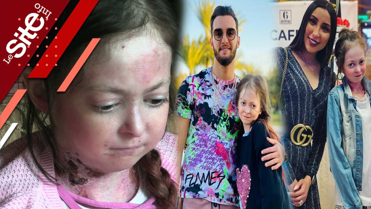 تعاني من مرض نادر.. قصة مؤثرة للطفلة سحر التي ربطت علاقات قوية مع مشاهير المغرب