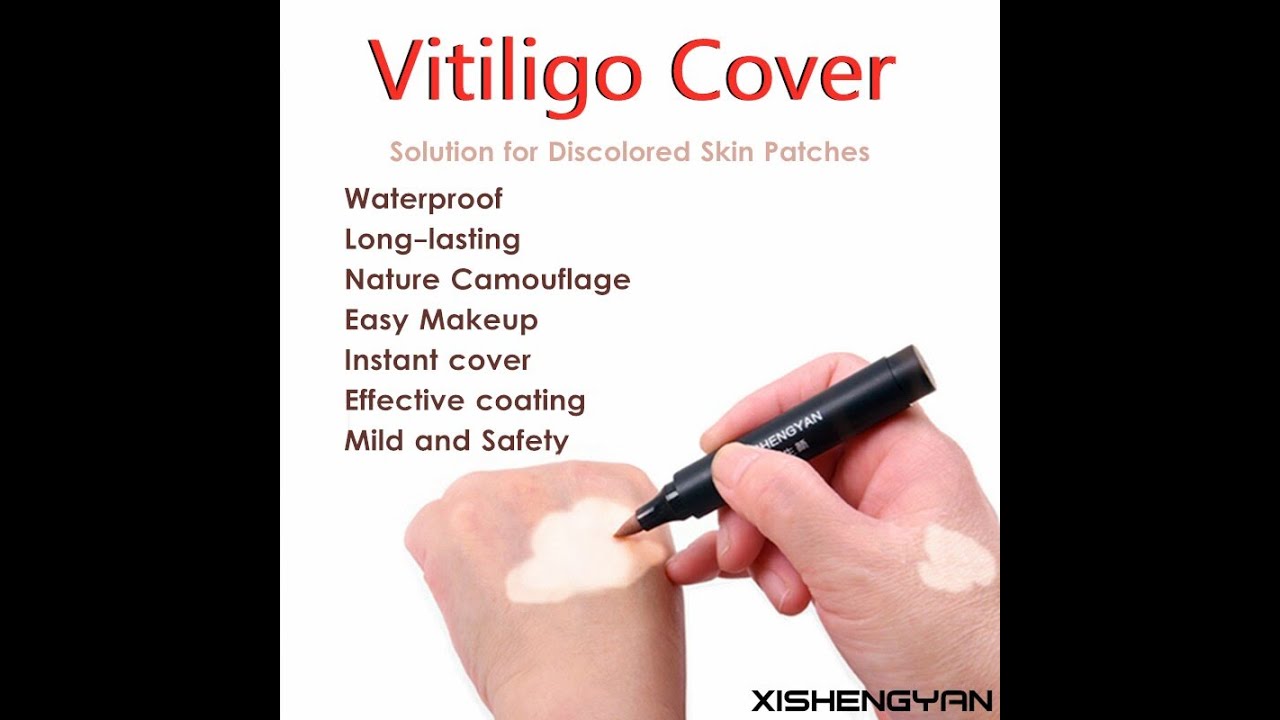 Coverage Waterproof Vitiligo Makeup Concealer Longlasting Camouflage