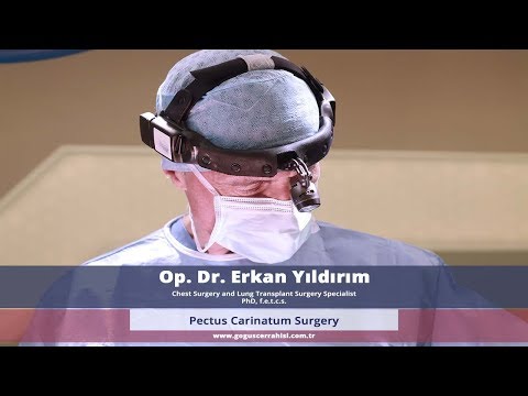 Video: Pectus Carinatum: Sümptomid, Ravi, Väljavaated Ja Palju Muud