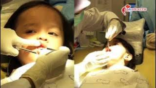 MyHEALTH : Angkat Bibir