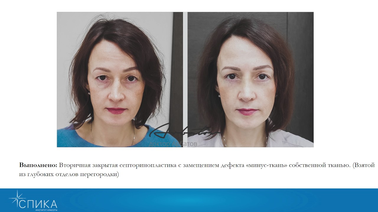 арбатов пластический хирург. арбатов вячеслав витальевич. арбатов вячеслав витальевич. арбатов вячеслав витальевич. арбатов вячеслав витальевич пластический хирург.