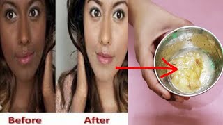 10 मिनट में चेहरा साफ़ और गोरा करने का घरेलू उपाय | Whiten Skin Treatment