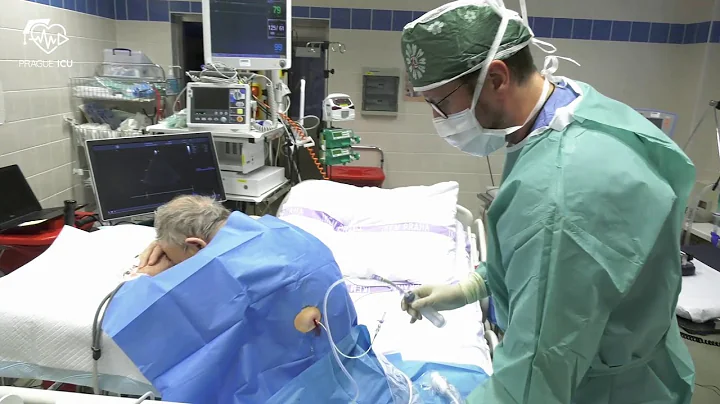 Pleural puncture (Thoracocentesis)