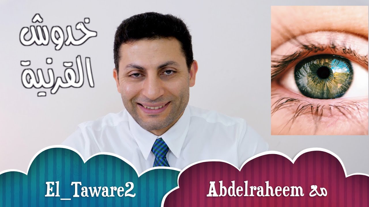 خدوش القرنية