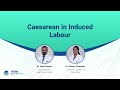 Caesarean in Induced Labour | Dr. Sunil Eshwar &amp; Dr. Shivani Chandan L | Aster RV | Aster Hospitals