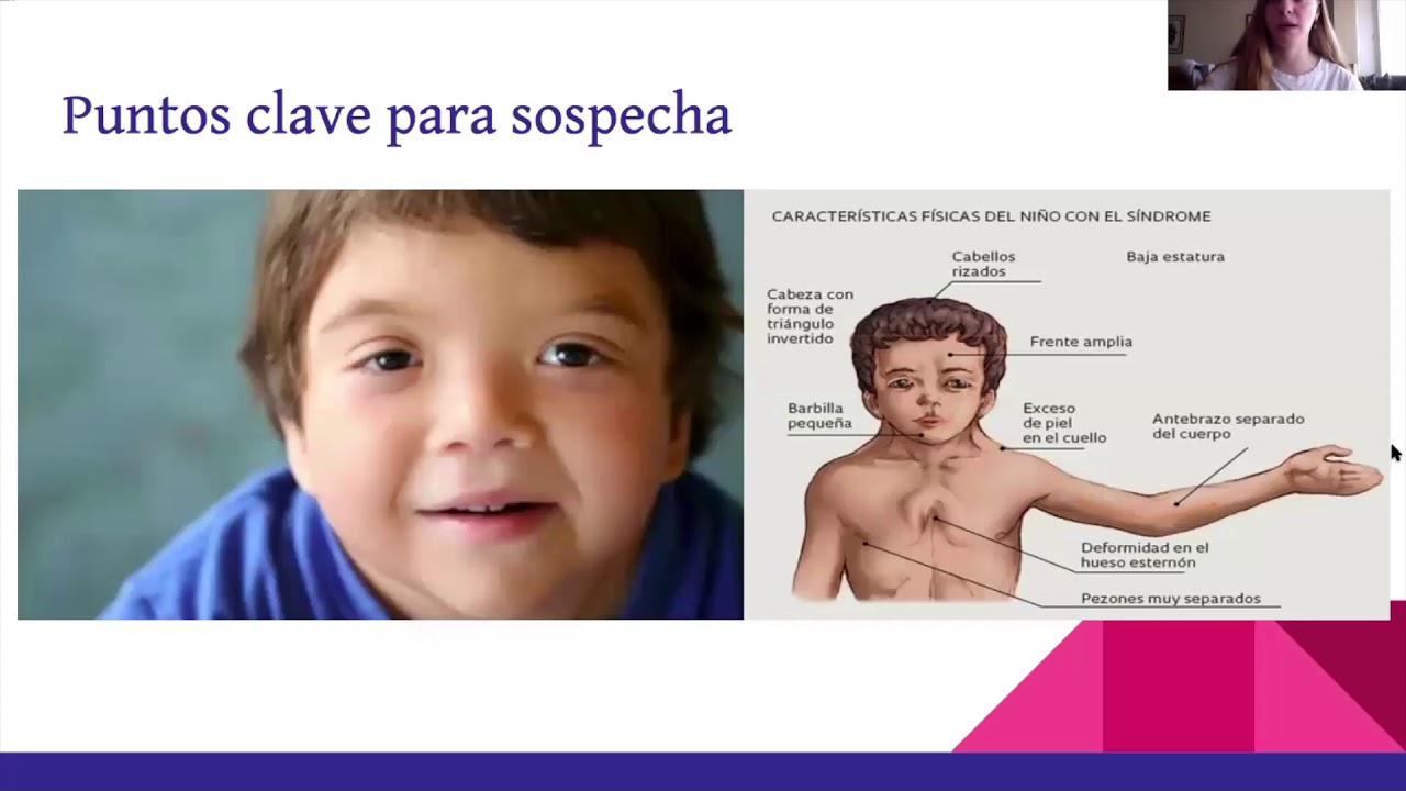 Síndrome de Noonan Nicole Ellstein Wolowelski YouTube