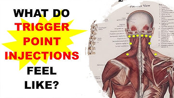 Trigger Point Therapy for Fibromyalgia Chronic Pain | What do Trigger Point Injections Feel Like?