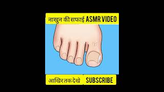 #asmr treatment #shortvideo #youtubeshorts #trending #viral #shorts