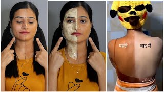 1 ही बार लगाने से Sun-Tan गायब| Best Pack For Sun-Tan| धूप का कालापन ख़त्म करे व पाए 1Shade Fair Skin