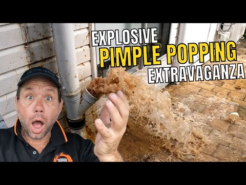 Blocked Drain 478 Explosive Pimple Popping Extravaganza